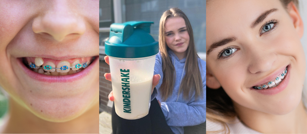 Eten met een beugel: zo krijgt je kind toch alle voedingsstoffen binnen